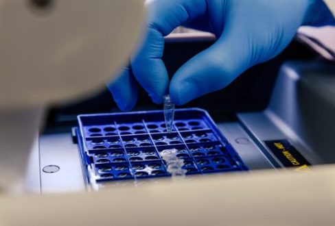 Clinical Sample Processing & Biobanking